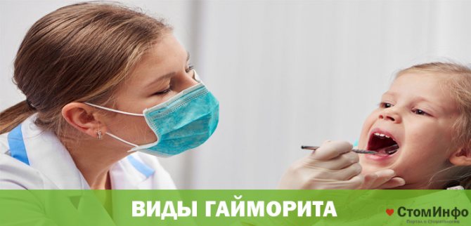 Виды гайморита