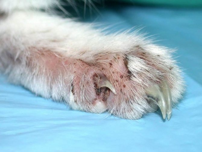 Если грибок был вызван серьезной инфекцией, в первую очередь лечат именно первопричину